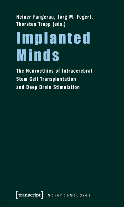 Cover des Buchs: Implanted Minds