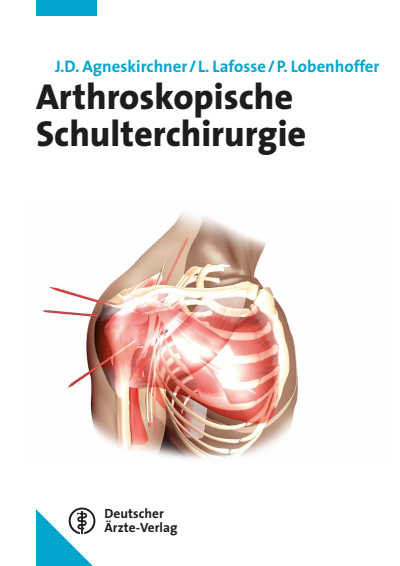 Cover des Buchs: Arthroskopische Schulterchirurgie