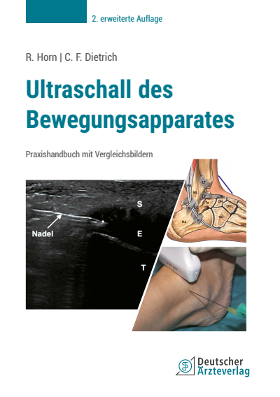 Cover of book: Ultraschall des Bewegungsapparates