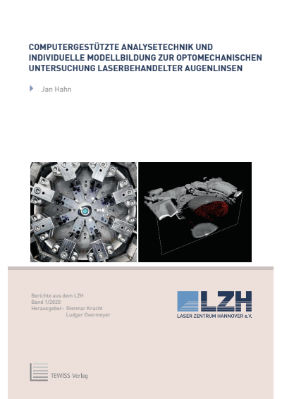 Cover of book: Computergestützte Analysetechnik und individuelle Modellbildung zur optomechanischen Untersuchung laserbehandelter Augenlinsen