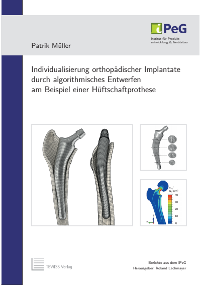 Cover of book: Individualisierung orthopädischer Implantate durch algorithmisches Entwerfen am Beispiel einer Hüftschaftprothese