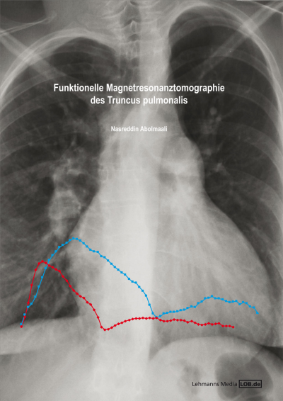 Cover des Buchs: Funktionelle Magnetresonanztomographie des Truncus pulmonalis