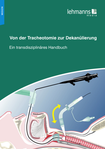 Cover des Buchs: Von der Tracheotomie zur Dekanülierung