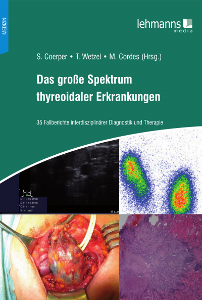 Cover of book: Das große Spektrum thyreoidaler Erkrankungen